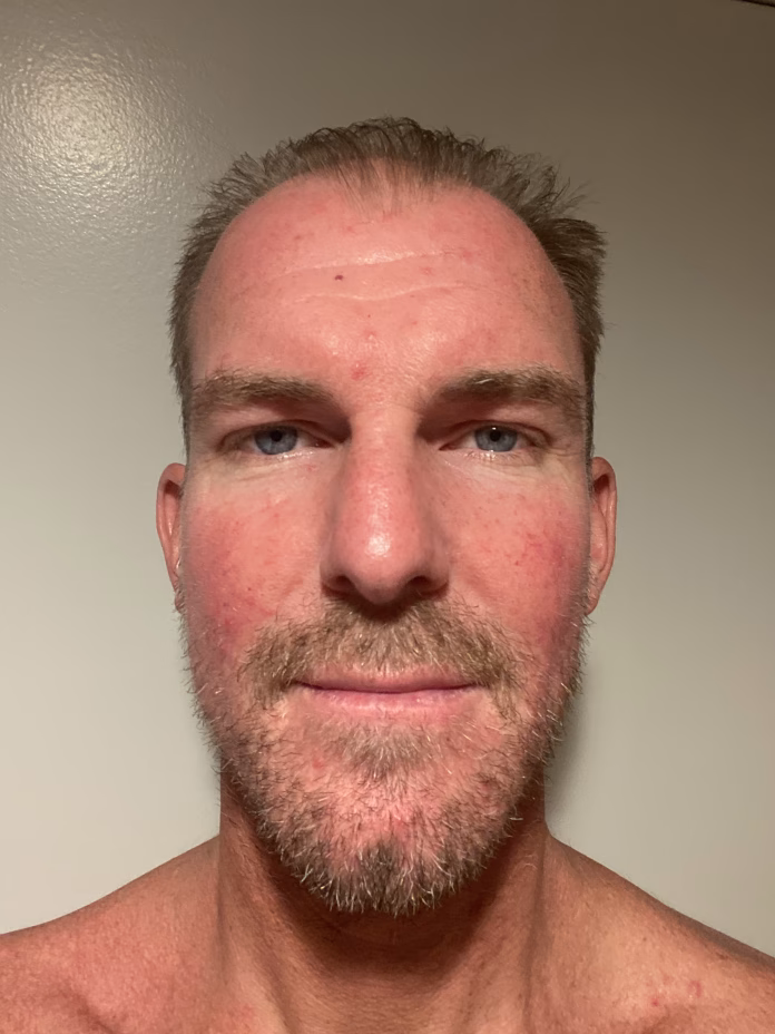 Matthew Dixon - Profile Photo