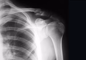 NJ Doctors Urgent Care - Project Casting Gallery Image 6 NJ Doctors Urgent Care - Gallery Image 6