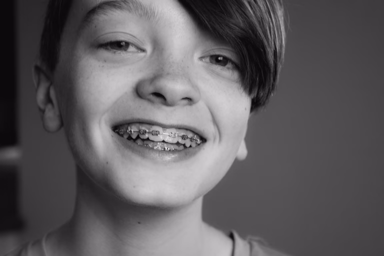 Casting Call: Teen Boys with Braces Needed for London Charity Commercial