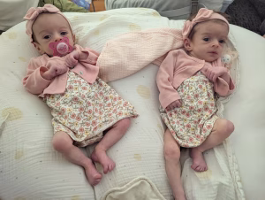 (IDENTICAL TWINS) Mabel & June  Esteves - Gallery Image 2