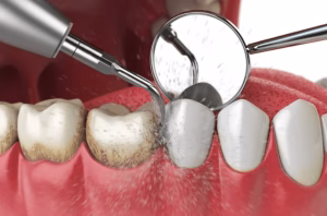 Chapel Street Dentistry - Gallery Image 2